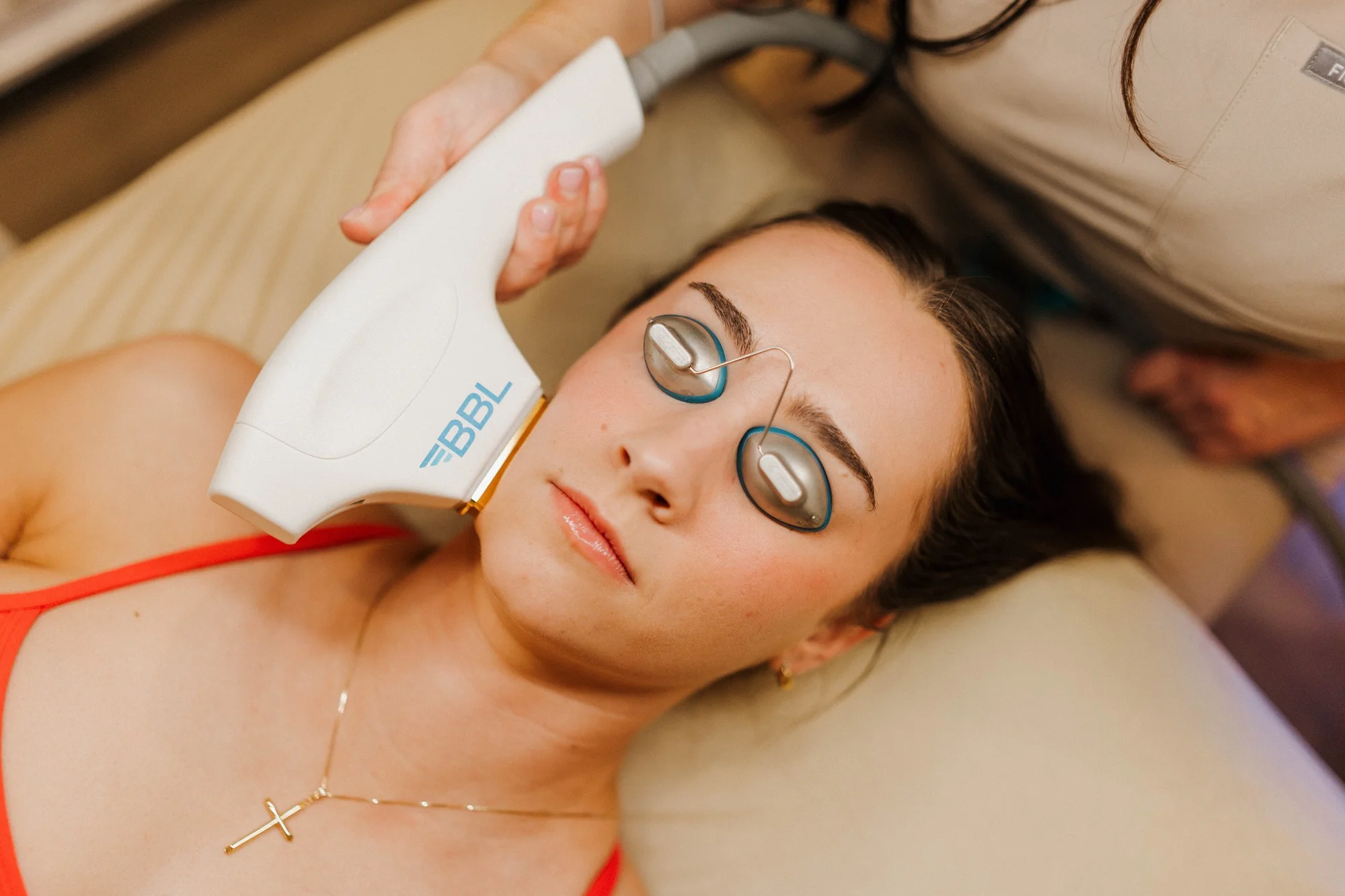 BBL Forever Young Photofacial in Albany, OR | Pure Beauty Aesthetics