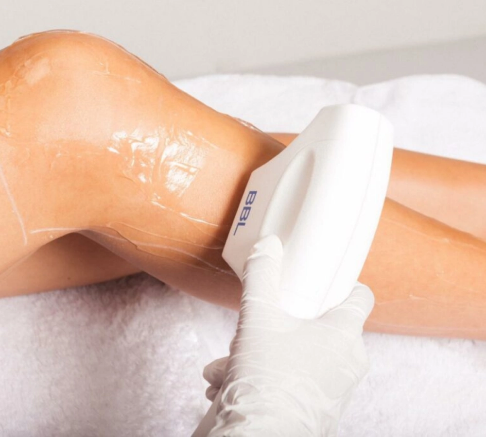 Forever Bare BBL Laser Hair Removal In Albany OR | Pure Beauty Aesthetics