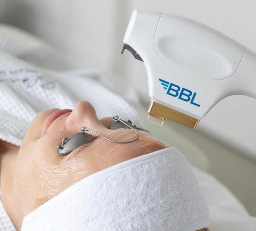 BBL HERO™ In Albany OR | Pure Beauty Aesthetics