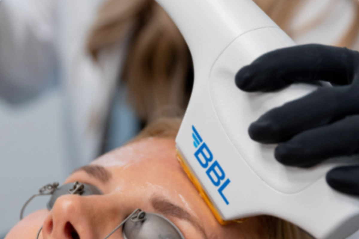 Forever Clear BBL Acne in Albany OR | Pure Beauty Aesthetics