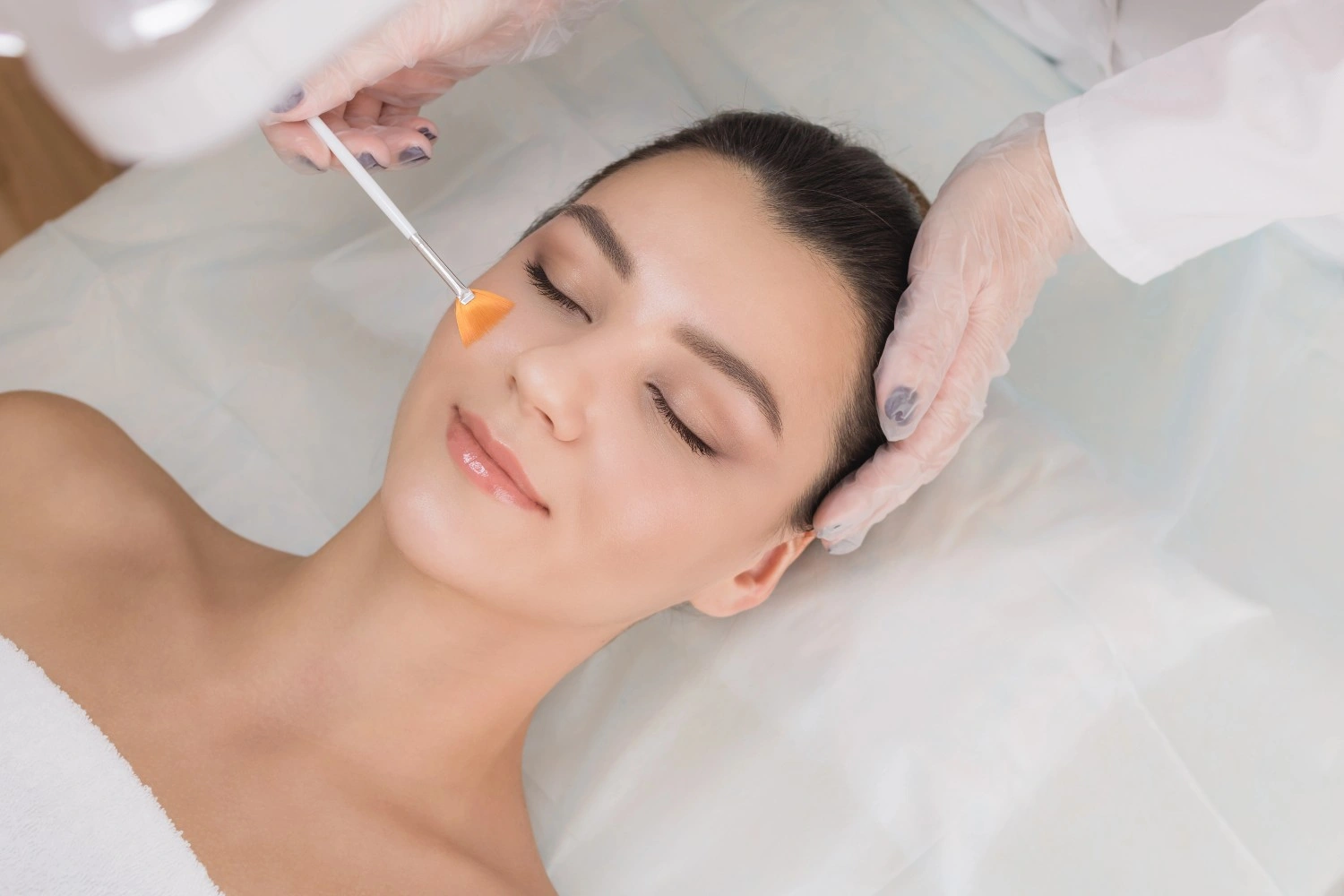 Patient getting Chemical Peels in Albano, OR by Pure Beauty Aesthetics