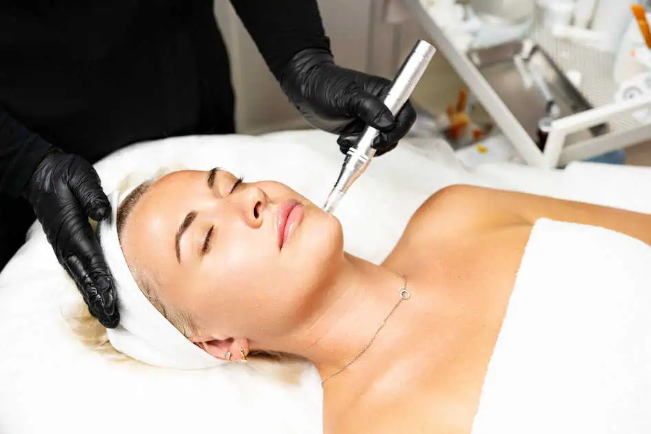 Vivace® Radiofrequency Microneedling by Pure Beauty Aesthetics, LLC in Albany, OR