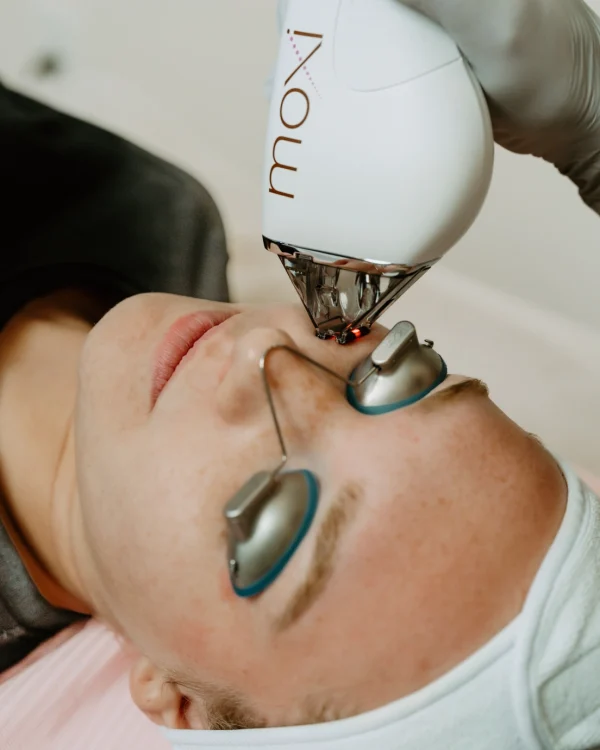 Lady Receiving Moxi Laser Treatment at Pure Beauty Aesthetics in Albany, OR