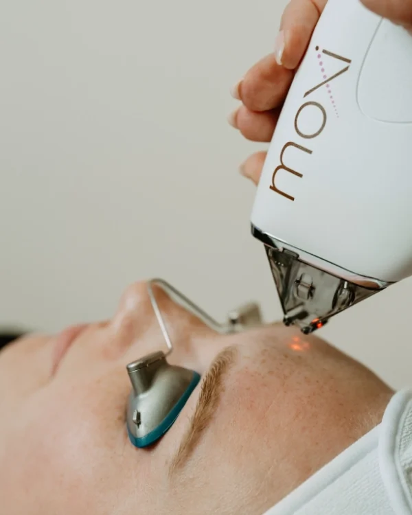 Woman getting Moxi Laser Treatment at Pure Beauty Aesthetics in Albany, OR