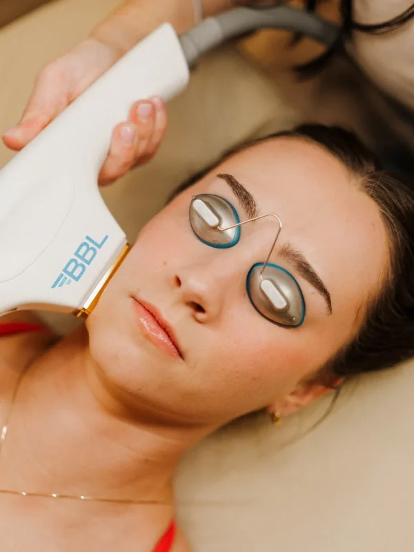 BBL Forever Young Photofacial in Albany, OR | Pure Beauty Aesthetics