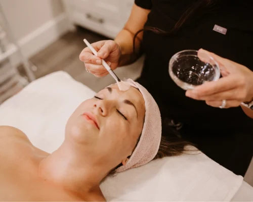 Chemical Peels In Albany OR | Pure Beauty Aesthetics