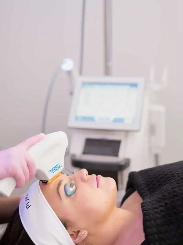 Woman getting BBL Photofacial treatment at Pure Beauty Aesthetics in Albany, OR