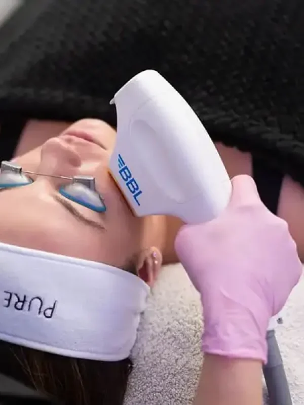 Lady Receiving BBL Forever young Photofacial in Albany, OR